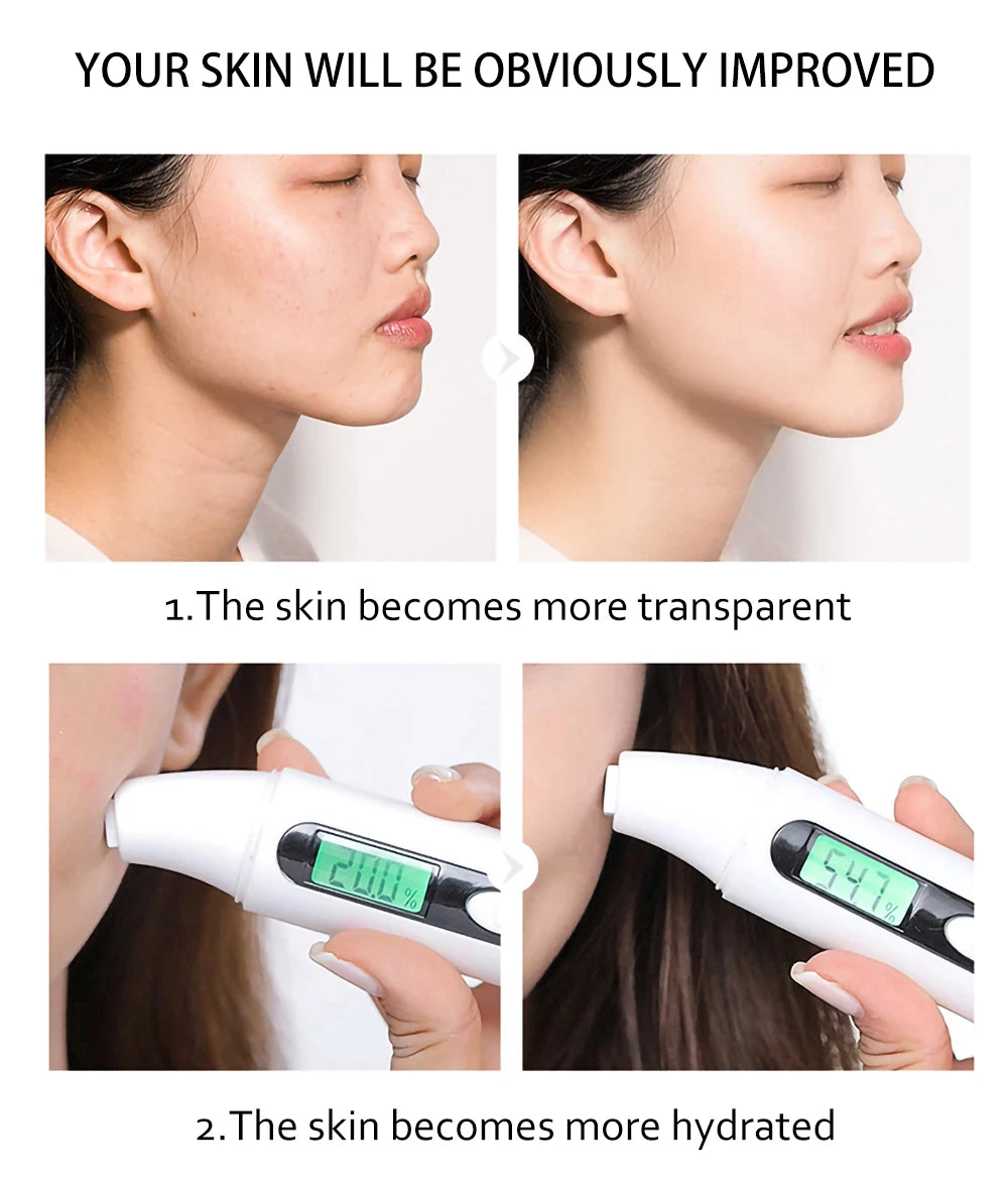Before and after comparison of skin improvement with a device, showing increased transparency and hydration.